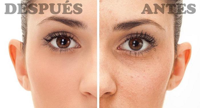 Jabón De Azufre - Antes y Después, Beneficios y Usos